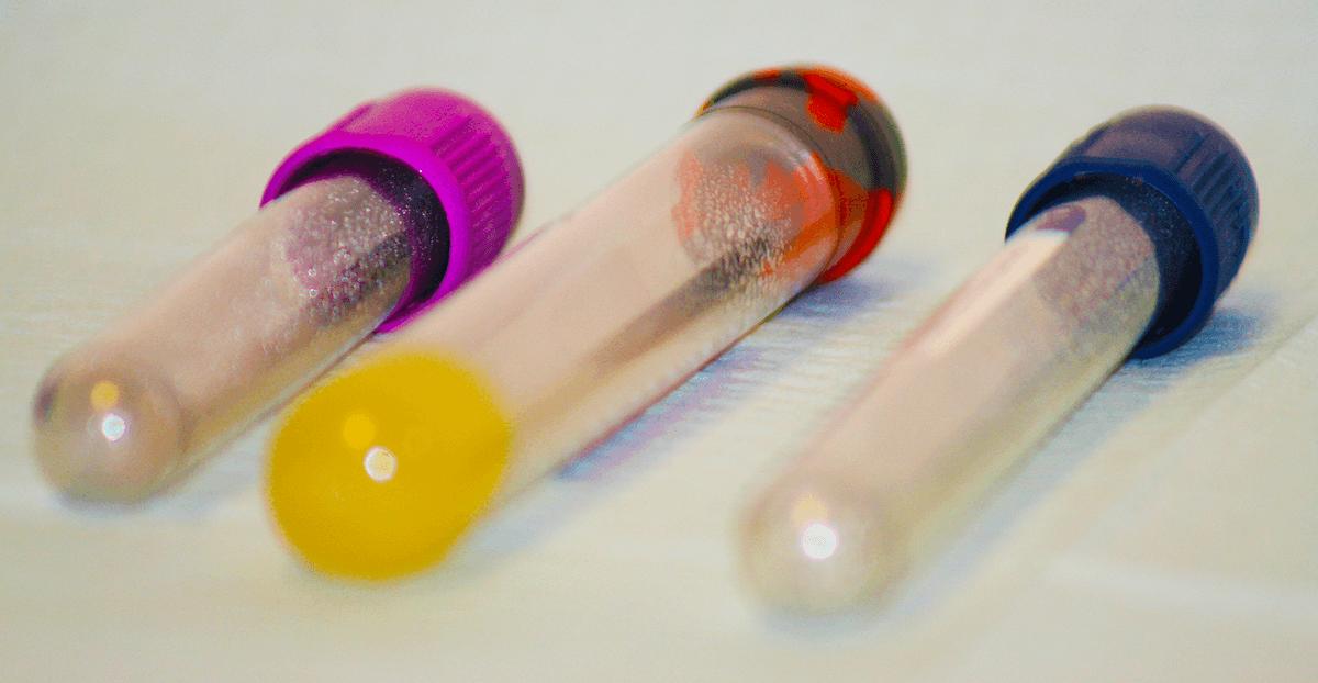 CHELATION PRE AND POST CHALLENGE TESTING Cont. - Consult Dr. Anderson