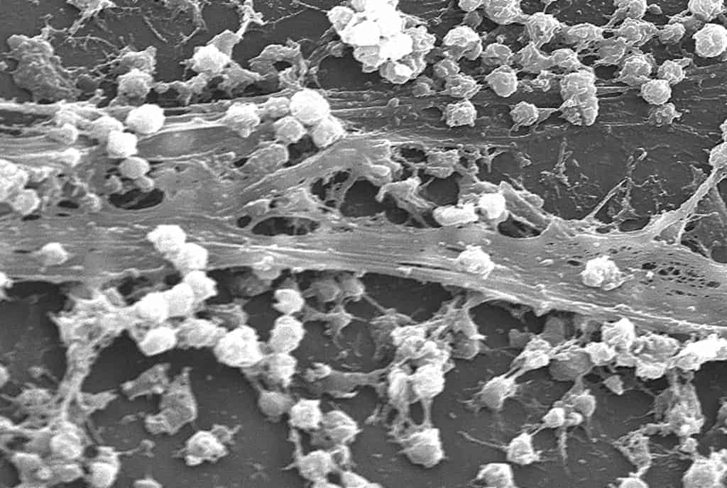 Staphylococcus aureus biofilm_01