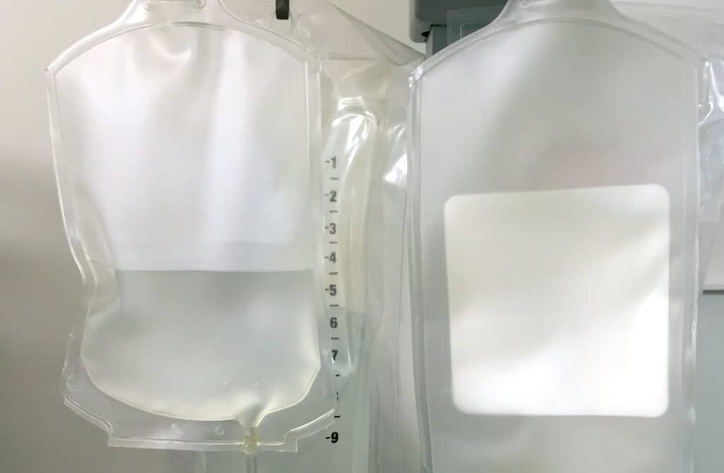 IV Fluids Saline versus Lactated Ringers Renal, Mineral and Cardiac